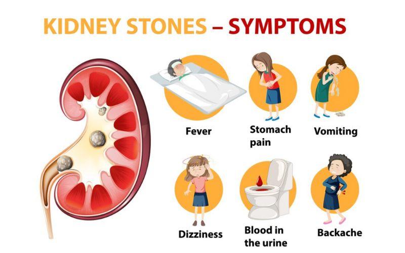 kidney transplant in India